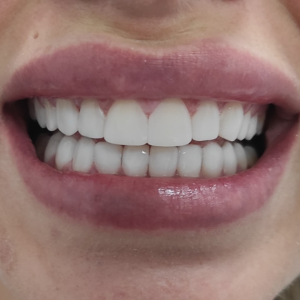 Clínica Dental en Córdoba Mauramed.