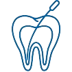 Endodoncia en Córdoba. Clinica dental en Córdoba Mauramed