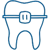 Ortodoncia en Córdoba. Clinica dental en Córdoba Mauramed