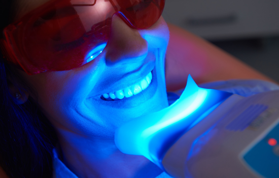 Blanqueamiento dental. Clinica dental en Córdoba Mauramed