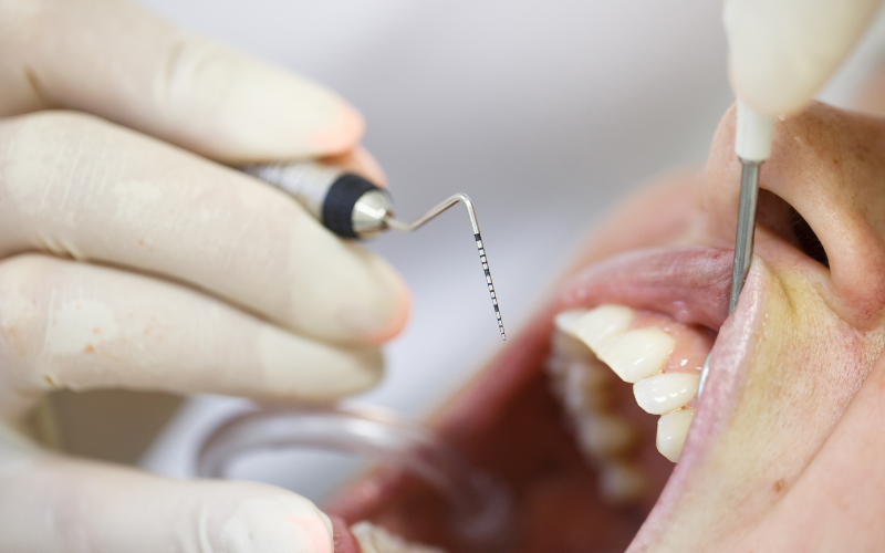 Especialistas en periodoncia clínica dental mauramed