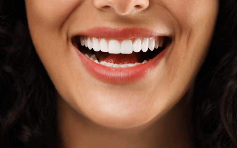 Estética dental. Clinica dental en Córdoba Mauramed