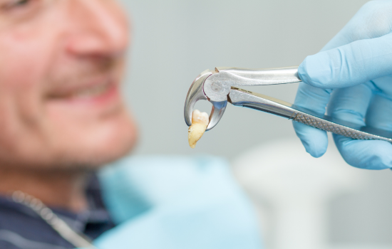 Extracciones dentales Clínica dental Mauramed