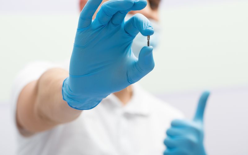 Implantes dentales en Córdoba Clínica Dental Mauramed