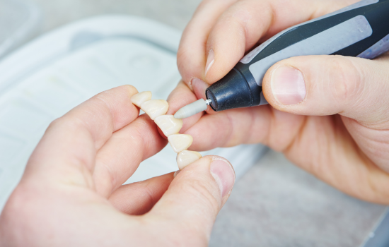 Prótesis fija sobre pieza natural clínica dental mauramed