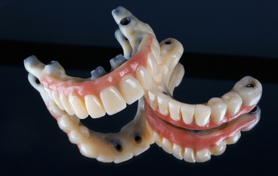 Prótesis sobre implante clínica dental mauramed