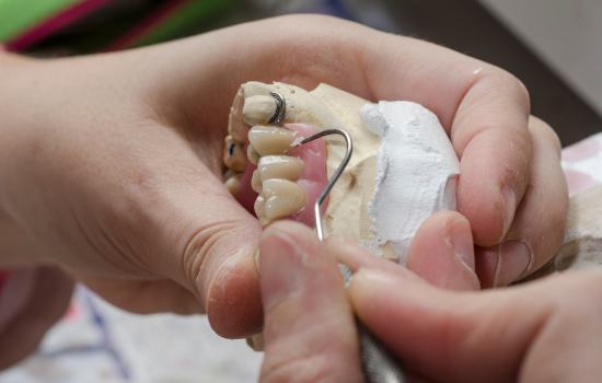 Prótesis parcial removible clínica dental mauramed