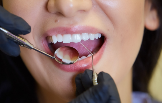Revision y diagnóstoco Clínica dental Mauramed