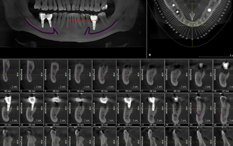Pruebas Diagnósticas Previas Clínica dental mauramed