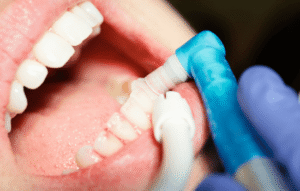 beneficios limnpiex¡za dental clinica dental en cordoba mauramded