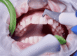 beneficios limnpiex¡za dental clinica dental en cordoba mauramded0