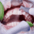 beneficios limnpiex¡za dental clinica dental en cordoba mauramded0