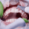 beneficios limnpiex¡za dental clinica dental en cordoba mauramded0