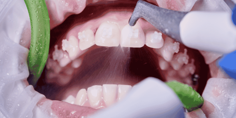 beneficios limnpiex¡za dental clinica dental en cordoba mauramded0 beneficios limnpiex¡za dental clinica dental en cordoba mauramded0