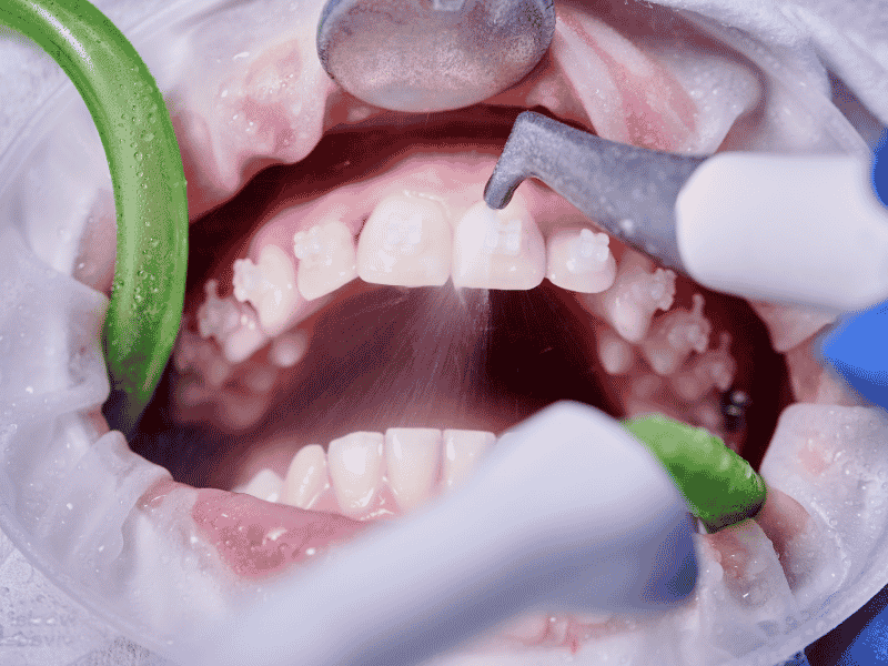 beneficios limnpiex¡za dental clinica dental en cordoba mauramded0