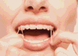 gomas de ortodoncia clinica dental en cordoba mauramed