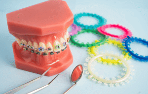 gomas de ortodoncia clinica dental en cordoba mauramed2