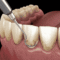 periodoncia clinica dental en cordoba mauramed