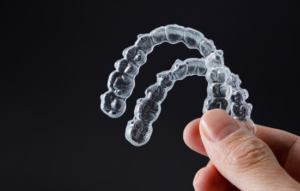 ortodoncia en cordoba. resupera la funcionalidad. clinica dental en cordoba mauramed